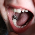 tooth